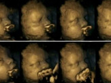 Imagens chocantes mostram diferença entre fetos de mães fumantes e não fumantes