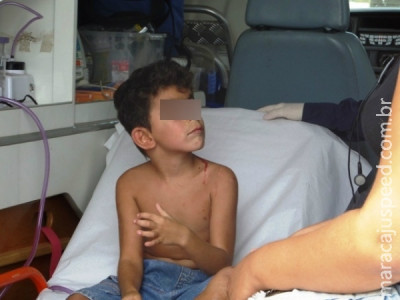 Menino de 06 anos cai de brinquedo e sofre traumatismo craniano
