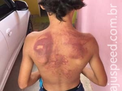 Padrasto é preso suspeito de agredir menino de 11 anos com sandália