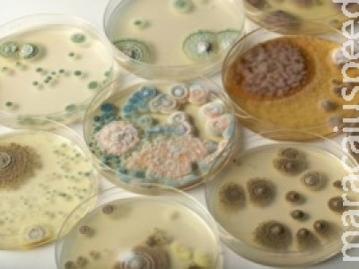 Higiene no preparo de alimentos evita contaminação por salmonella