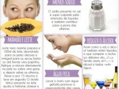 Dicas para acabar com as olheiras