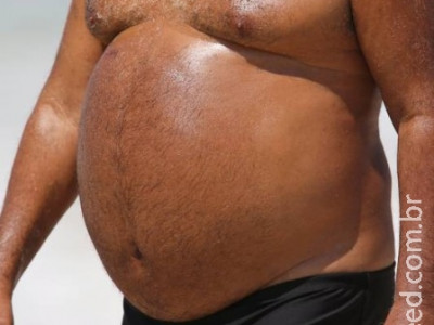 Brasileiros obesos se dizem felizes, mas têm doenças e vida sexual ruim