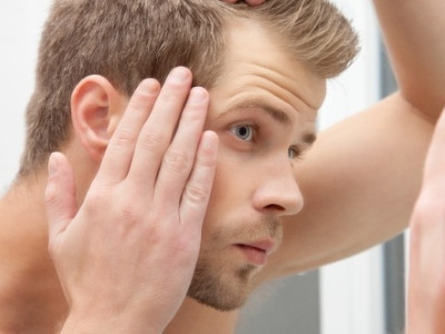 Genética? Estresse? Veja dez mitos e verdades sobre calvície masculina 