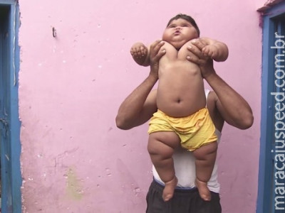 Menina de 10 meses tem peso de criança de 6 anos