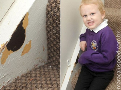 Menino com raro transtorno come tudo o que vê pela frente 