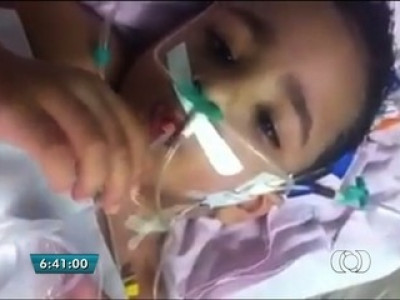 Pai posta imagem do gêmeo siamês que sobreviveu se recuperando