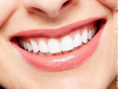  Genvivoplastia: mude sua gengiva de forma simples e sem dor