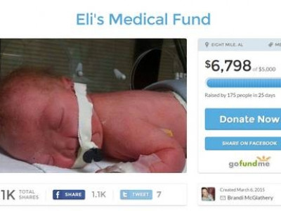 Família arrecada dinheiro para o tratamento de bebê que nasceu sem nariz  