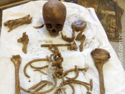 Silicone encontrado com ossada é de desaparecida há 12 anos