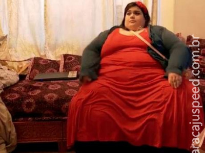  Com 292kg, jovem já pesava 70kg aos cinco anos