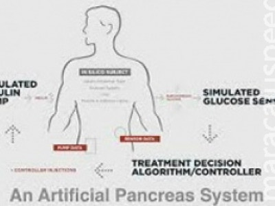 Tecnologia israelense ajuda a controlar níveis de glicose