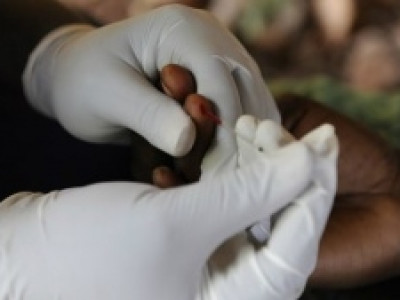 Projeto visa reduzir o número de infecções sexualmente trasmissíveis