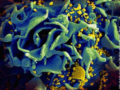 Uso de "pílula do dia seguinte" do HIV aumentou 186% desde junho no Brasil