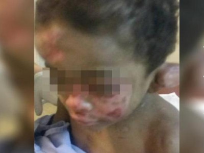 Pais de menino torturado perderam a guarda por envolvimento com drogas