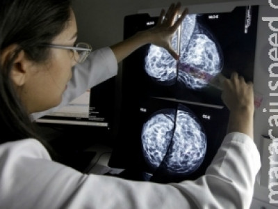 Pesquisa brasileira pode aumentar longevidade de pacientes com câncer de pulmão