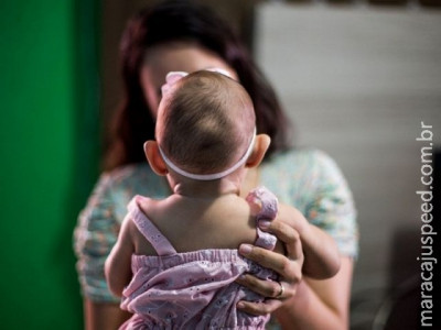 Estudo sobre zika pode levar Brasil a mudar protocolo de microcefalia