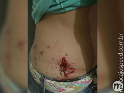 Marido tenta sufocar esposa depois de descobrir troca de mensagens com ex