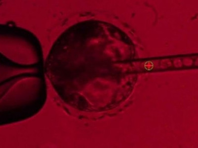Cientistas criam órgãos humanos em porcos para transplante