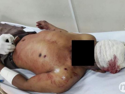 Fotos de feridos confirmam tiros em confronto entre índios e fazendeiros