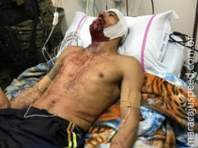 Acusado de metralhar Rafaat tenta fuga de hospital