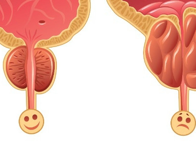 Brasileiro cria alternativa a cirurgia que deixa homem sem ejacular