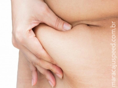 Flacidez no pós-parto pode ser hereditária? Veja 8 mitos e verdades