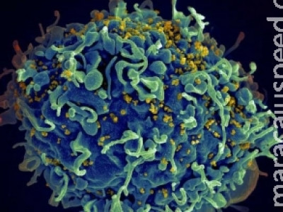 Pesquisadores desenvolvem estratégia para impedir reprodução do HIV