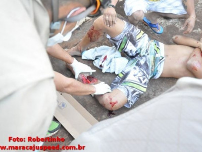 Maracaju: Colisão entre motocicleta e caminhonete deixa vítima com perna gravemente fraturada