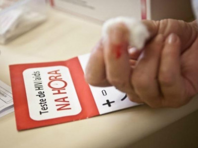 Taxa de mortalidade por Aids tem queda de 42%