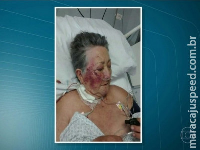 Idosa é agredida por enfermeiro na UTI