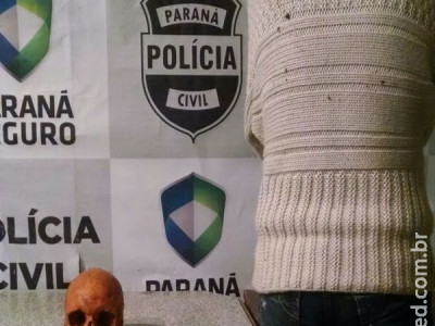 Enfermeiros encontram crânio em bolsa de paciente