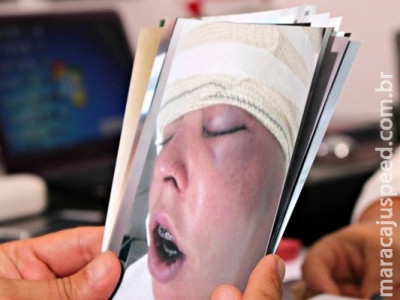 TJ mantém indenização a jovem espancada pelo namorado