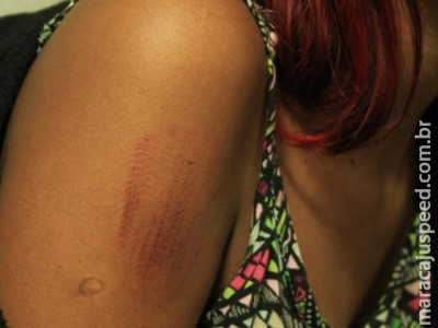 Dupla quebra portão, invade casa e fere adolescente a pedradas