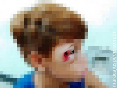 Menino de 10 anos é agredido com pedaço de madeira por rapaz