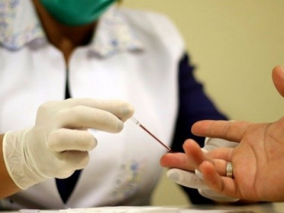 Pacientes com hepatite C terão mais duas opções de medicamento