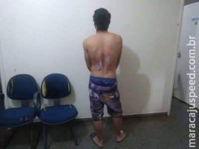 Jovem tenta fugir de abordagem, cai e é preso