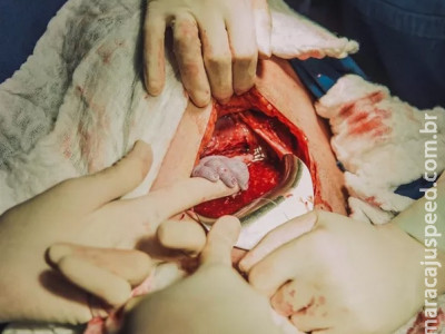 Foto emocionante: bebê segura na mão da obstetra antes mesmo de nascer