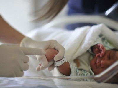 Pediatras pedem fim da obrigatoriedade do Teste da Linguinha