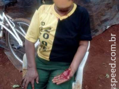 Homem é preso após espancar a mãe com pauladas em Dourados
