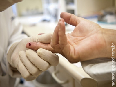 Brasil reduz em 8% casos de infecção por tuberculose e HIV