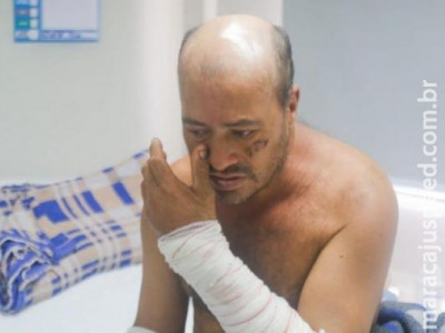 Atacado por pitbull, Carlos chora e pede ajuda para voltar a SP