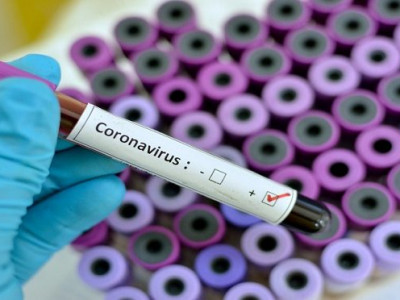 405 o número de infectados no MS, Maracaju possui um caso suspeito de COVID-19 e nenhum caso confirmado segundo boletim epidemiológico