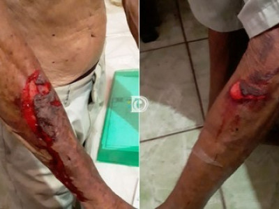  Idoso fica ferido ao ser amarrado e amordaçado em roubo 