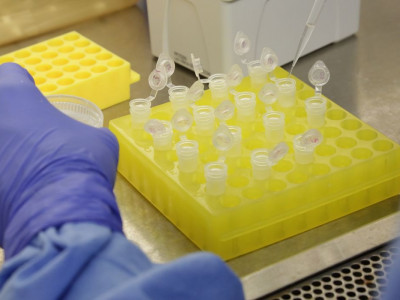 Testes para vacina contra HIV têm resultados promissores