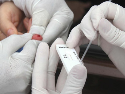 Brasil registra 2.545 mortes por covid-19 nas últimas 24 horas