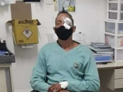 Homem ferido no olho em ação da polícia em protesto no Recife vai processar estado