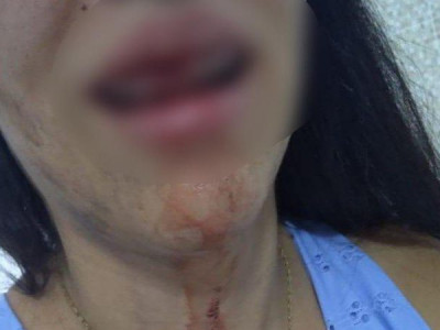 Mulher é espancada até desmaiar e marido diz para PM que ‘caiu’