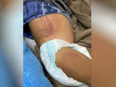 Mãe e padrasto são presos suspeitos de agredir filhos