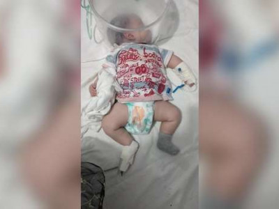 Bebê de 2 meses é internado em estado grave com covid-19
