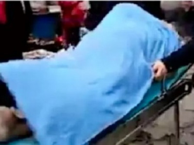 Homem passa cola no pênis e morre durante relação sexual 